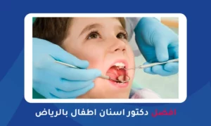 افضل دكتور اسنان اطفال بالرياض
