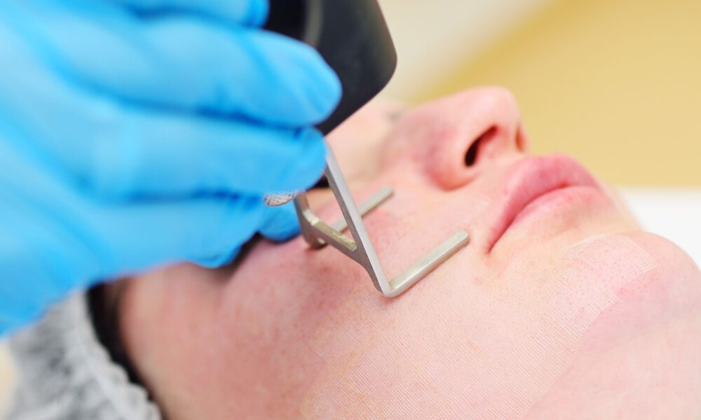 أفضل عروض ليزر بالرياض بأسعار تناسبك وتقنيات GentleLASE وSplendor X