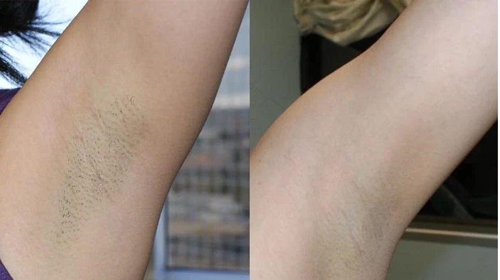 51199-قبل-وبعد