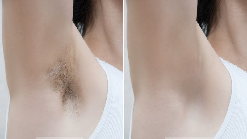 إالة-الأشعار-قبل-وبعد