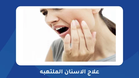 علاج الاسنان الملتهبه