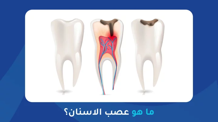 ماهو عصب الاسنان